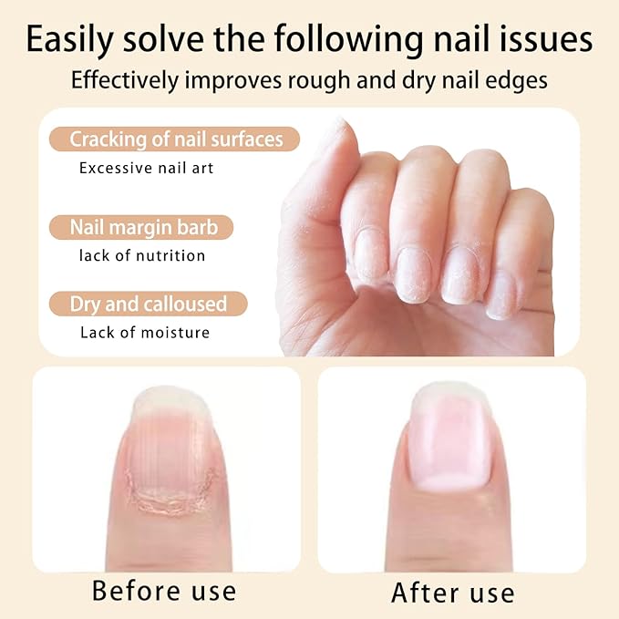 Cuticle Oil Pen for Nails Care,Nail Oil For Strength,Nourish Moisten Care Nail Cream To Reduce Nail Cracking and Dry for Weak Peeling Brittle and Thin Nails (Strawberries&peaches)