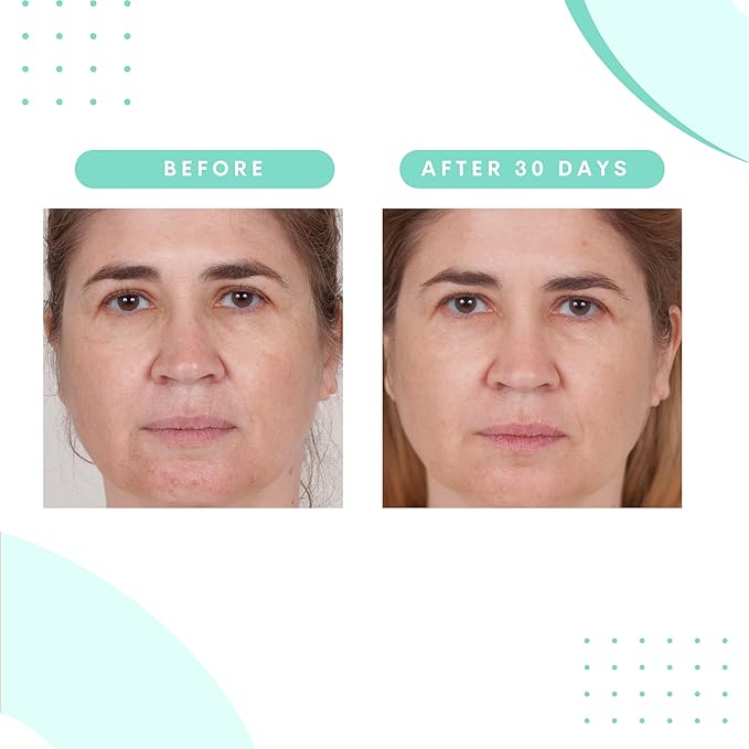 Serious Skincare Glycolic Skin Renewal Set Retexturizing