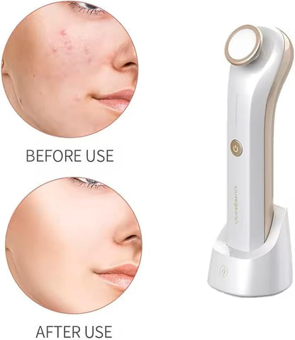Plasma Facial Device, Ozone Skin Care Machine, Face Massager for Acne Treatment, Brightening, Anti-Wrinkle