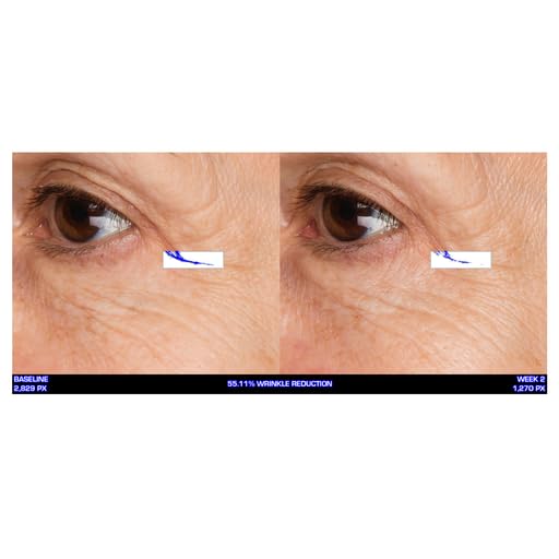 Serious Skincare Ultra-Mare Pure Marine Infusion oz