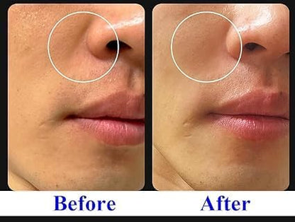 Exceptional Regenerating Serum: Lifts, Volumizes, and Revitalizes with SCM, 5% Volufiline, T1 Collagen, and PHA (30ml, 1oz)