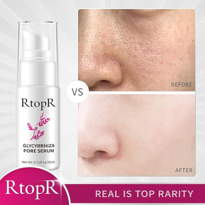 RtopR Glycyrrhiza Pore Soothing Serum