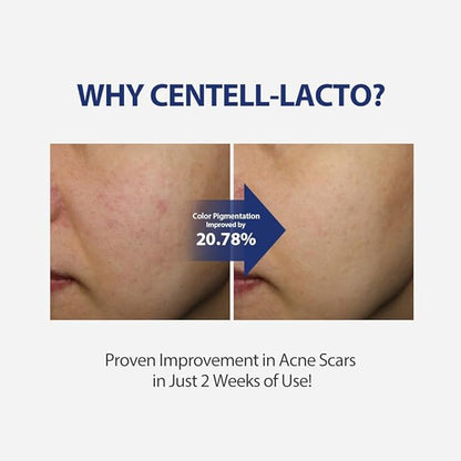 SUNGBOON EDITOR Centell Lacto AC Less Skin Barrier Serum | Probiotic & Niacinamide Face Serum for Sensitive, Blemish-Prone Skin | Lightweight, Non-Greasy Hydrating Korean Skincare