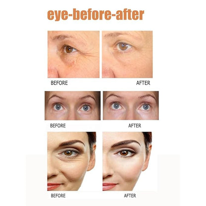 2Pack Instant Temporary Eye Cream Set,Visuasource 1ml Eye Tightening Serum Quickly Firming Reduces Under-eye puffiness,Dark Circles,Under-Eye Bags Instant Firm Eye Tightener Cream For Men Women