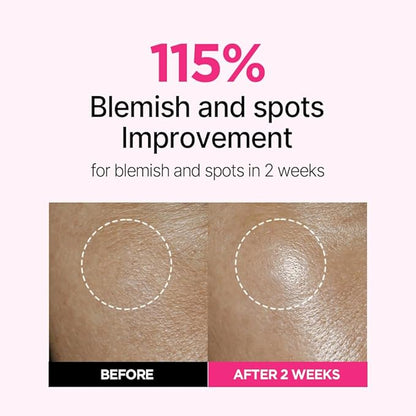 ISOI Blemish Care Up Serum Triple Set, Korean Skin Care for Glass Skin Radiance, Includes 2 Full Size & 1 Refill Serums, Eye & Wrinkle Patch Tester, Daily Hydration Gift Set (2.13 fl. oz)