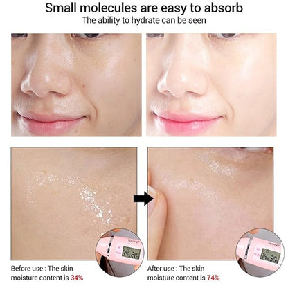 AICHUN BEAUTY Face Serum Eye Essence Anti-Wrinkles Anti-Acne Oil-Control Anti-Freckle Refreshing Moisturizing Purifying Shrink Pores 30ml 1.01FL.oz (10% Alpha Arbutin + 5% Mandelic ACID Face Serum)