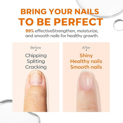 modelones Cuticle Oil and Nail strengthener, 15ml Nail & Cuticle Care Strengthener Oil Vitamin E + B Cuticle Revitalizing Oil for Nail Growth and Gel Nail Polish