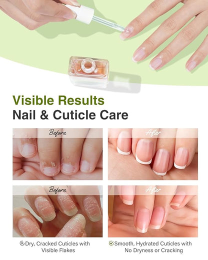 EJW Luxurious Camellia Nail & Cuticle Oil – Infused with Real Flower Extracts, Deeply Hydrating & Strengthening, Nourishing Elegance, Vegan & Paraben-Free – 0.5 fl. oz