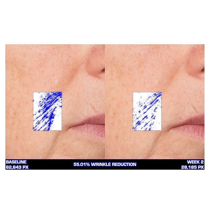 Serious Skincare Ultra-Mare Pure Marine Infusion oz