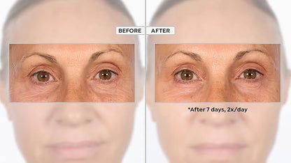 PRAI Beauty - Ageless Eye Advanced Eye Serum 0.5 oz