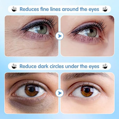 Hydrating Under Eye Patches for Dark Circles & Puffy Eyes - 60 Pairs Eye Mask with Hyaluronic Acid, Blueberry & Centella - Vegan, Cruelty-Free Skincare