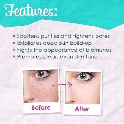 Bye Bye Blemish Skin Resurfacing Regimen Set, with Witch Hazel & Tea Tree Skin Toner, Skin Resurfacing Peel Serum, and Skin Rescue Serum with Niacinamide and Zinc, Cruelty-Free, Bundle Pack