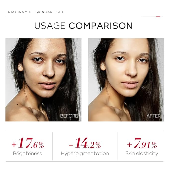 Niacinamide Skincare Set: 4pcs Beauty Kit