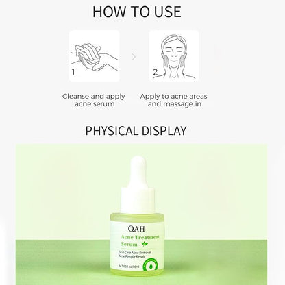 Oil Control Acne Serum