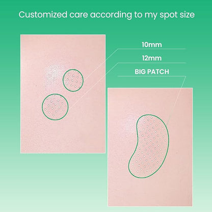 ilso No Problem Spot Patch, 72 Patches in 3 Sizes, Hydrocolloid Acne & Pimples Patches with Hyaluronic Acid and Niacinamide to reduce acne, White dots absorbed, Korean Skincare