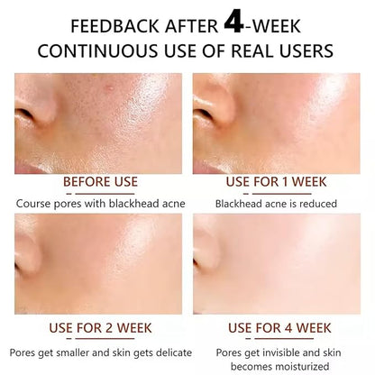 Antioxidants rich 20% Vitamin C Serum for Face with Glycolic Acid and Hyaluronic Acid -RED light therapy serum Boosts Collagen production, Fades Dark Spots, ANTI-AGING, nighttime use (9 serum in 1)