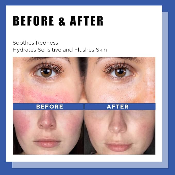 It'S SKIN LI Calming Skincare Set