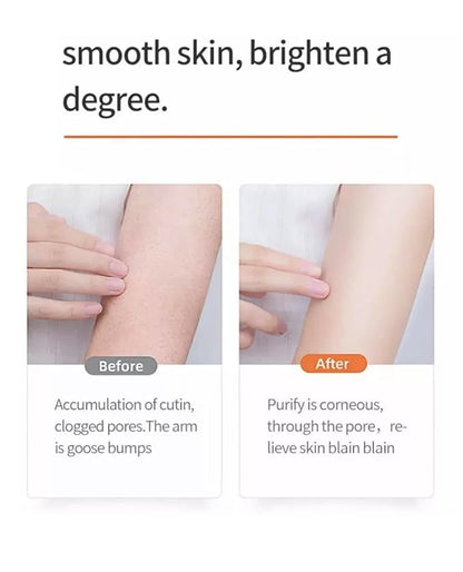 Bright Smooth Niacinamide Pecan Body Scrub – 200mL / 7.04 fl oz – Exfoliating Scrub for Body Acne & Dead Skin – Gentle, Hydrating, Non-Drying Formula for Smooth, Renewed Skin