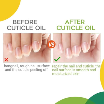 modelones Cuticle Oil and Nail strengthener, 15ml Nail & Cuticle Care Strengthener Oil Vitamin E + B Cuticle Revitalizing Oil for Nail Growth and Gel Nail Polish