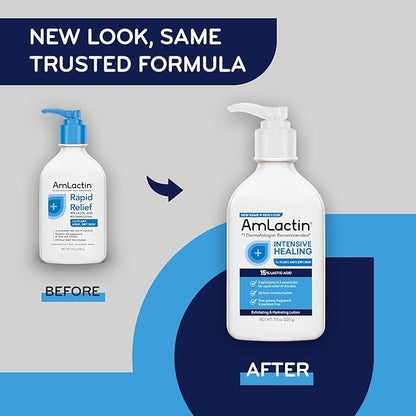 AmLactin Intensive Healing Body Lotion for Dry Skin – 7.9 oz Pump Bottle & Ultra Smoothing-4.9 oz Body & Hand Cream with 15% Lactic Acid-Exfoliator and Moisturizer for Rough and Bumpy Dry Skin