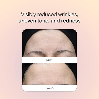 Solawave Red Light Therapy Device for Face & Body | Near Infrared Light Therapy for Rejuvenation | Portable Facial Skincare Solution | Soothes & Depuffs Skin, Reduces Appearance of Lines & Wrinkles