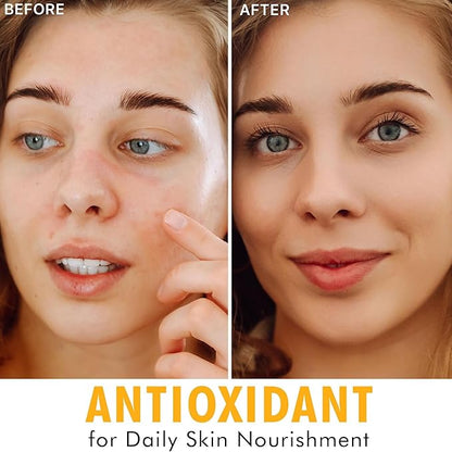 Vitamin C Face Serum - USA Made with Natural & Organic Ingredients, Skin Brightening Vitamin C Serum for Face for Women, Discoloration Correcting & Anti Aging Facial Formula with Antioxidants