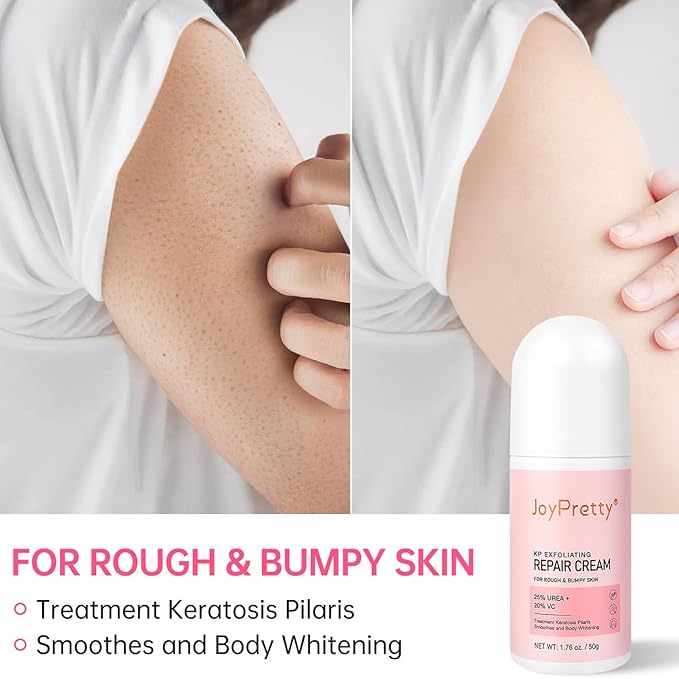 Strawberry Legs Treatment For Women,Bump Eraser