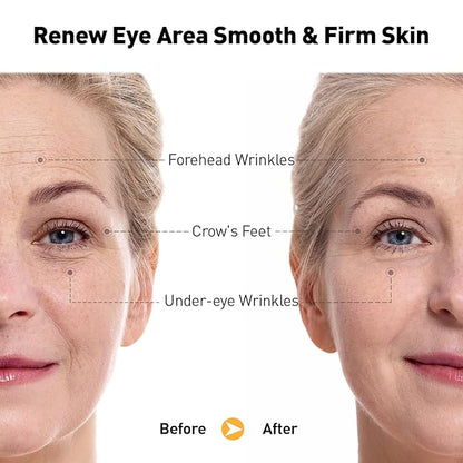 Retinol Eye Cream for Anti-Aging & Wrinkles - Firming & Repair Under Eye Serum with Retinol, Niacinamide, Hyaluronic Acid, Vitamin E & Bifida Ferment Lysate, 0.7 Fl Oz (Pack of 1)