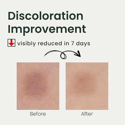 THE LAB BY BLANC DOUX Green Flavonoid 5.0 Serum & 2.0 Sunscreen Soothing Hydrating Moisturizing Facial Treament SPF 50 for Sensitive Acne-Prone Skin Korean Beauty Skincare