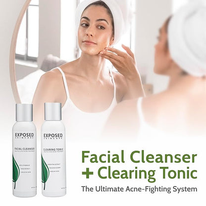 Exposed Skin Care Expanded Acne Treatment Kit - Includes Salicylic Acid Face Wash, Clearing Tonic, Treatment Serum with Benzoyl Peroxide, Clear Pore Serum, Moisture Complex - Made for All Skin Types