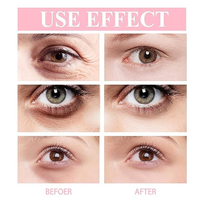 3PCS Retinol Eye Cream Stick, Hydrating Eye Balm, Retinol Eye Cream for Dark Circles and Puffiness, Eye Serum Balm Skin Care