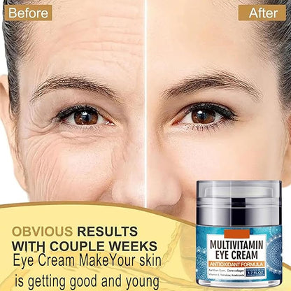 Eye Cream for Women, Multivitamin Eye Cream Under Eye Cream for Dark Circles Anti Aging and Wrinkle Deeply Moisturizing Reduces Bags Puffiness Face Tightening Eye Lift 1.7oz