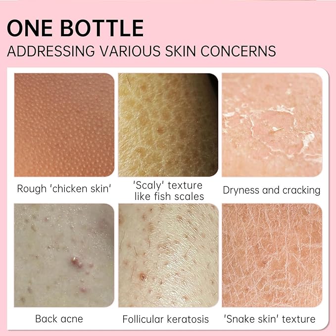 Strawberry Legs Treatment For Women,Bump Eraser