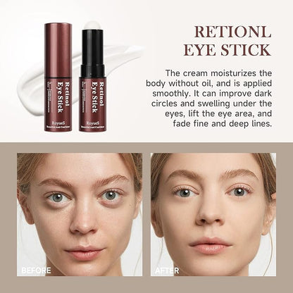 AKARY Retinol Eye Cream for Dark Circles and Puffiness, Skincare Under Eye Cream Eye Stick Reduce Wrinkles and Fine Lines, Skin Tightening Cream Moisturizing Treatment Cream Smooth and Hydrate Eye Area, Suitable for Sensitive Skin, 0.24oz