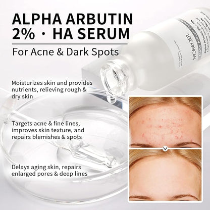 Alpha Arbutin 2% + HA Serum for Anti Aging & Wrinkles, 2 PCS Moisturizing Alpha Arbutin Serum 2%, Hyaluronic Acid, Niacinamide for Acne & Spots, Hyaluronic Acid Essence for Face.