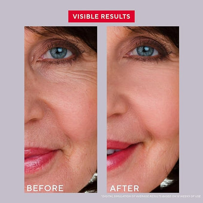 Mirabella Replenish & Restore Multi-Peptide Anti Aging Face Serum for Hyperpigmentation & Redness Relief - Vitamin C & 0.5% Retinol Infused Dark Spot Corrector