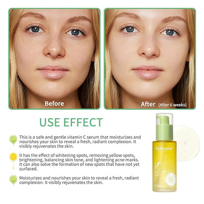 NICEFACE Green Tangerine Vitamin C Face Serum - Facial Serum with Vitamin C, Niacinamide & More - Brightening Serum for Dark Spots, Balancing Skin Tone, and Lightening Acne Marks (50ml), transparent