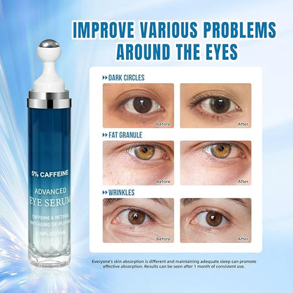 5% Caffeine Eye Cream & Under Eye Serum for Dark Circles and Wrinkles, Under Eye Bags Treatment, Anti-Aging Caffeine Eye Serum with Hyaluronic Acid and Niacinamide, 360° Eye Roller Massage(20ML)