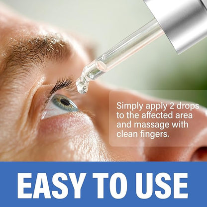 ITECFREELY Stye Eye Treatment, Natural Stye Eye Relief Drops Serum for Styes Chalazion and Blepharitis, Fast Chalazion Remover for Restore Healthier Skin-1 Fl.oz