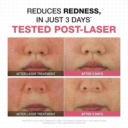 Physiogel Moisturizer Cream and Ampoule Vitamin C Face Serum, Korean skin care, Reduces Redness in just 3 days, Hydration for Dry & Sensitive Skin, Soothing & Hydrating Serum.