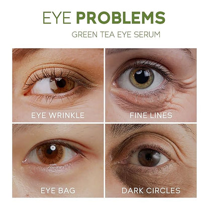 AKARY Green Tea Eye Serum and Under Eye Roller Cream, for Eye Bags Puffiness, Caffeine Eye Cream with 360° Massage Ball Reduce Wrinkles and Fine Lines, Under Eyes, Moisturizing, Hydrating, Firming Eye Skin (Green Tea)