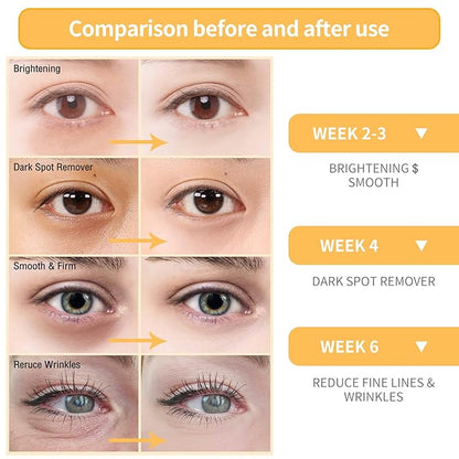 BREYLEE Vitamin C Serum for Face & Eye (o.6 oz) for Brightening Skin,Dark Spot Remover,Reduce Wrinkle,Anti Aging Serum,Moisturizer Brightening Serum with Hyaluronic Acid,Vitamin E,Retinol, Niacinamide
