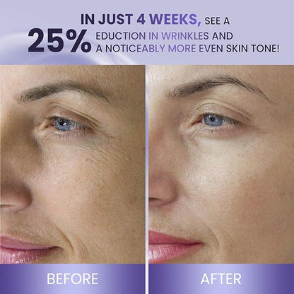 ABERA BELANI Retinol Night Cream For Women, Dark Spot Remover, Melasma Treatment, Reduce Fine Lines, Anti-Wrinkle, Anti-Aging Neck and Décolleté For Face (1 Box + Gift Eyelash Serum)
