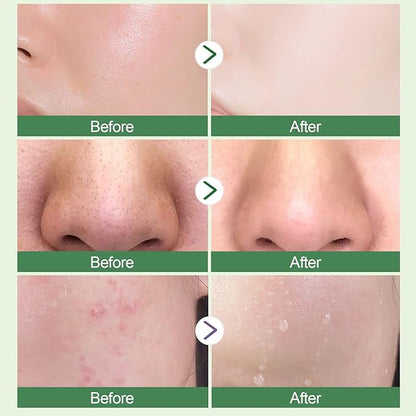 Green Tea Purifying Clay Face Mask, Blackhead Remover With Green Tea Extract, Face Moisturizing，Deep Pore Cleansing for All Skin Types of Men And Women (1 PCS)