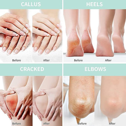 Urea Cream 40 Percent For Feet Plus 2% Salicylic Acid 8.82 oz || Foot Cream and Hand Cream Maximum Strength with Hyaluronic Acid, Tea Tree,and Aloe Vera for Deep Moisturizes, Callus Remover and Soften