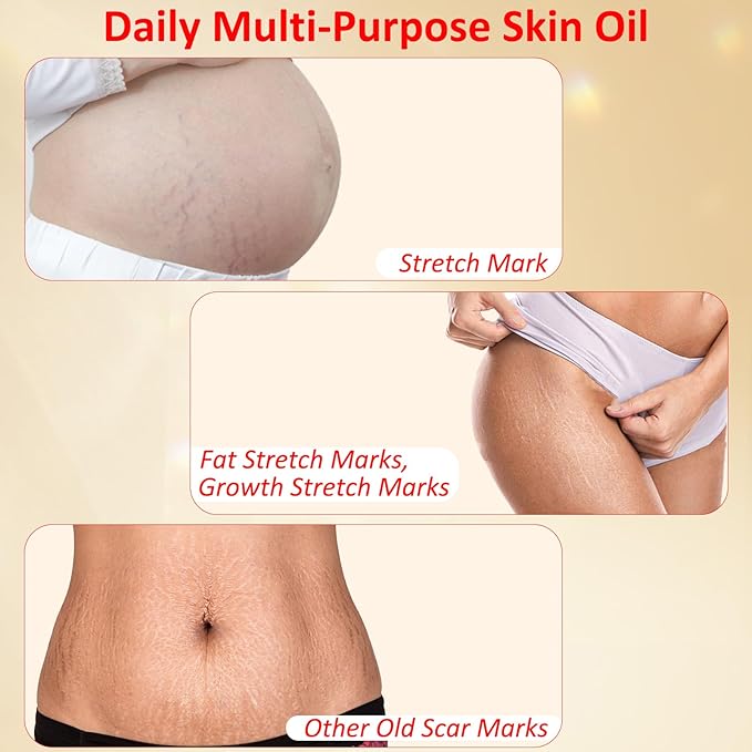 Stretch Mark Oil for Pregnancy, Skincare fl.oz