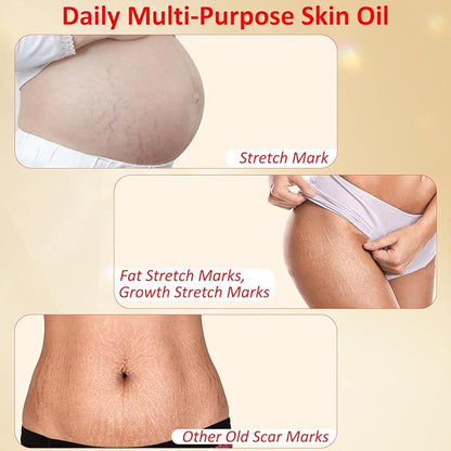 Stretch Mark Oil for Pregnancy, Skincare fl.oz