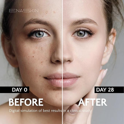 Dark Spot Corrector for Face and Body: EnaSkin 50ML Spot Remover for Age Spot Sun Spot Freckles Melasma Brown Spot for Men and Women (1.7 Fl Oz)