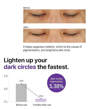 SOME BY MI Retinol Intense Advanced Triple Action Eye Cream – 1.01Oz, 30ml – Korean Retinol Under Eye Cream Anti Aging for Fine Lines – Brightens Dark Circles & Smooths Skin Texture – Korean Skin Care