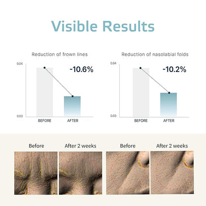Forehead Wrinkle Patches – 8pcs | Labottach Korean Skincare Hydrogel Firming Patch for Between Eyes, Smile Lines & Fine Lines with Adenosine, Tartaric Acid | Stretch & Lift | Home Skin Care